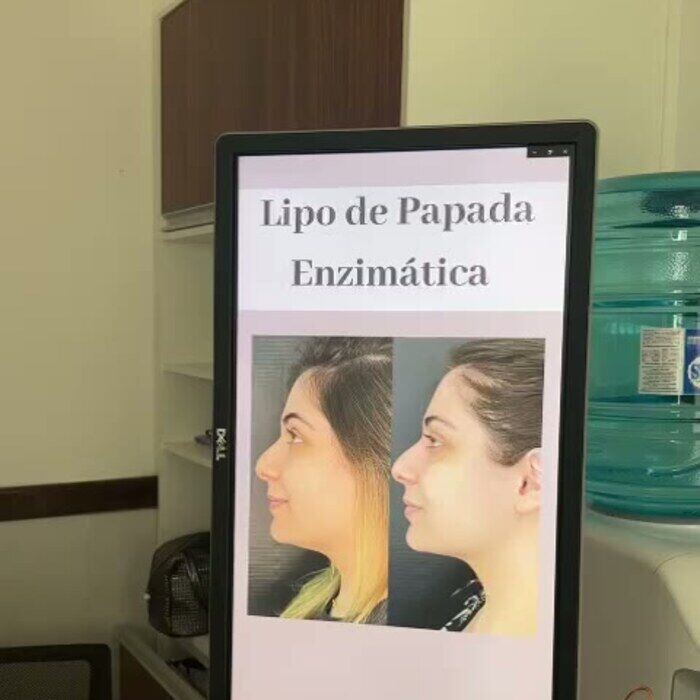 TV Engajada na clínica de Dra. Valéria Albani